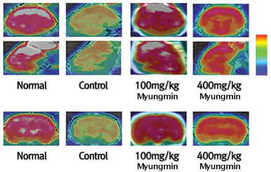 Myungmin glucose metabolism in brain